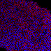 Immunofluorescent image of hESC culture labeled with DSHB antibody MC-631 (SSEA-3) against SSEA-3 (red). Image Credit: Elena Ibáñez. PMID: 38914137, Fig. 3C.